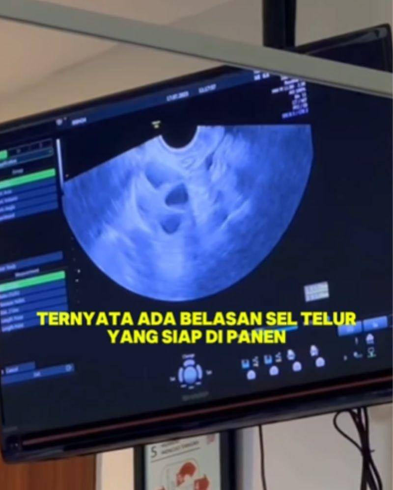 Instagram.com/sumargodenny